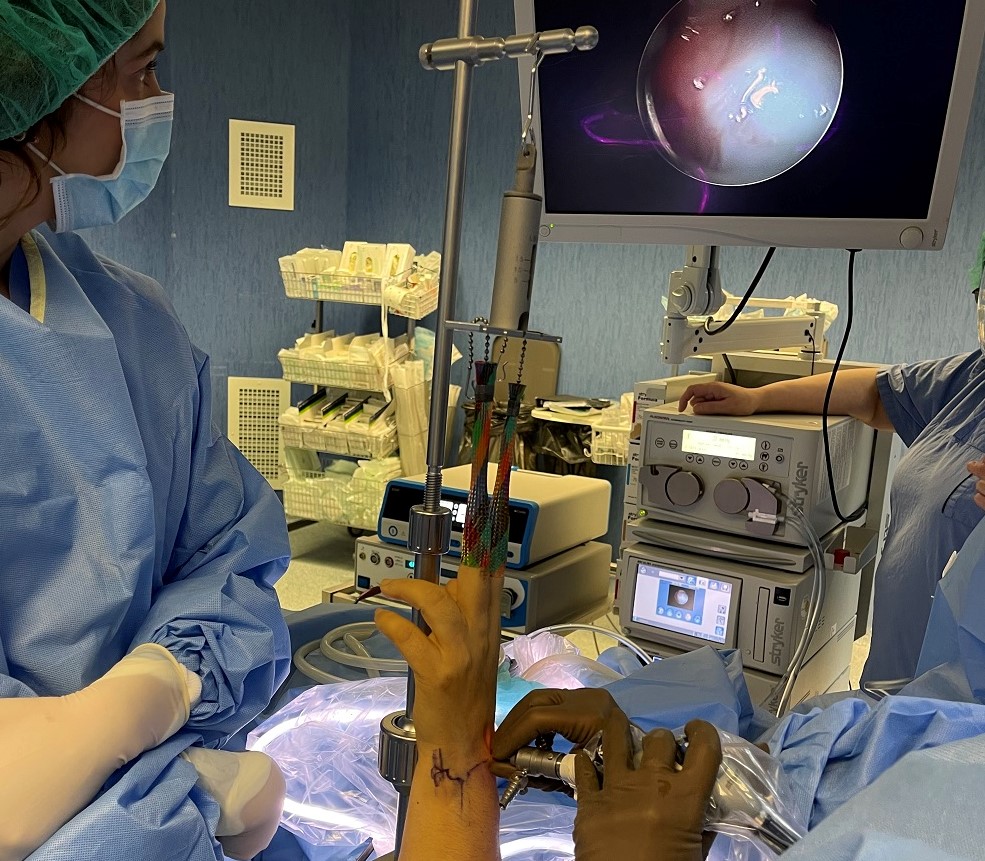 Serviço de Ortopedia da ULS do Nordeste realiza primeira artroscopia do punho